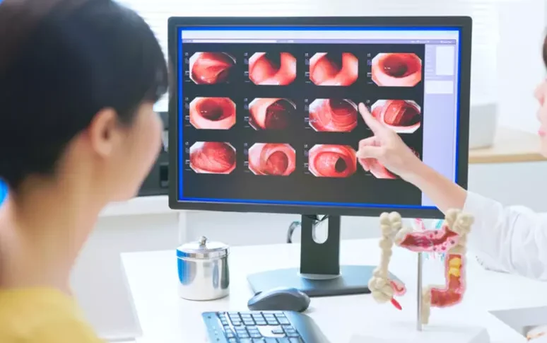 Tumore al colon, nuovo studio dimostra che la guarigione completa è possibile Tumore al colon, nuovo studio dimostra che la guarigione completa è possibile