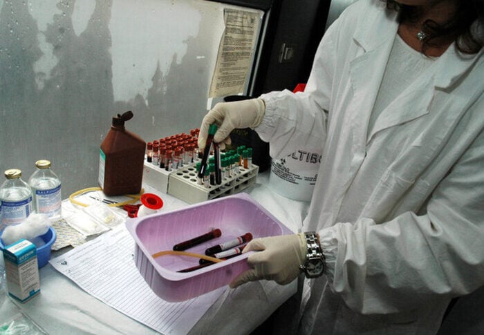 Epatite A, casi in aumento in Italia: sotto osservazione anche il nord della Calabria Epatite A, casi in aumento in Italia: sotto osservazione anche il nord della Calabria